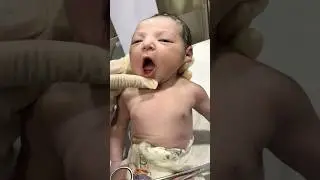 Adorable baby 🥰 #nicufighter #premature #prematurebirth #newborncare #cutebaby #prematurebaby