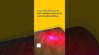 Is Laser Hair Removal in Frisco, TX Worth It? Find Out Now!