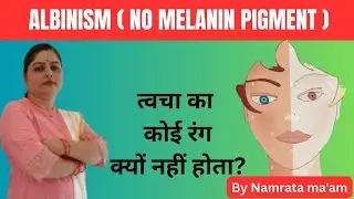 Albinism | Cause & symptoms | Genetic disorder explained