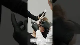 SURGICALCAPS.COM. 😷💉  @zurichplastics top plastic surgeon  plastic surgery clinic - Switzerland 🇨🇭