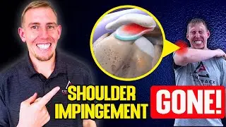 Fix Your Shoulder Impingement: 3 Essential Tests and Exercises for Lasting Pain Relief!