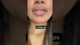 Jiore Litlip lip transformation 🔥