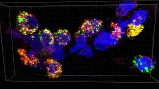 8-Year-Old Human Lung D036 SFTPB and ABCA3 Enhanced Resolution_002