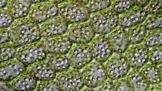 Lophozia silvicola oil bodies
