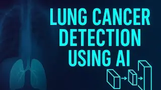 Lung Cancer Detection AI Capstone Project for Class 12 2025-26