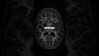 Depression kann dich denken lassen das du Schmerzen hast!..