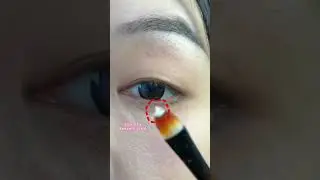 Magic glue a day, keeps the plastic surgery away 🧑&zwj;⚕️