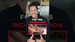 Neuropathy usually begins as a circulation issue.