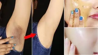 বিশ্বের সর্বশ্রেষ্ঠ উপায় বগলের কালো দাগ দূর হবে, ত্বক কাঁচের মত উজ্জ্বল চকচকে হবে । Best Life Hacks