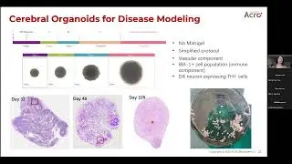 Advancing Drug Development and Disease Modeling with Human iPSC-derived Organoids