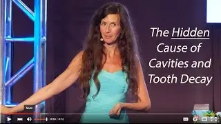 The Hidden Cause of Cavities and Tooth Decay