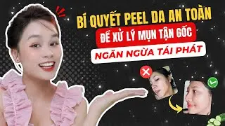 Bí Quyết Peel Da An Toàn Để Xử Lý Mụn Tận Gốc Và Ngăn Ngừa Tái Phát | Hoàng Ngoan Beauty