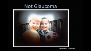 What does Glaucoma do to your vision?