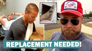 &lsquo;Home Town&rsquo; Star Ben Napier Faces Full Ankle Replacement After Horrific Basketball Mishap #hgtv