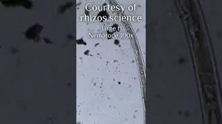 Large ff Nematode 100x