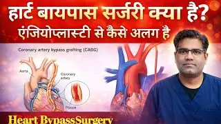 Heart Bypass surgery क्या है? किन मरीजों में की जाती है 