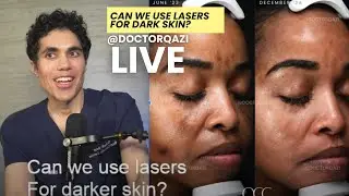 Dr. Qazi discusses Can We Use Lasers for Dark Skin? | Dr. Qazi Unsponsored Live | 3.12.2025