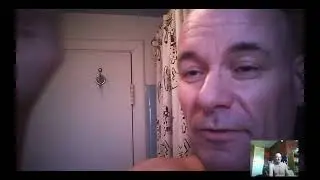 Morgellons madness update: Calcium deposits, bunions, arthritis ...