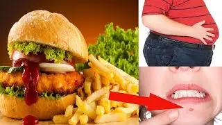 Fast Food Bad Health Effects | What Happens To Your Body When You Eat Too Much Fast Food ?