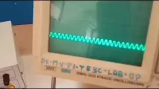 EEE   Experiment No  7 First Order Butterworth Filter