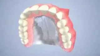 Proth&egrave;se dentaire compl&egrave;te amovible (dentier) - Centres dentaires Lapointe