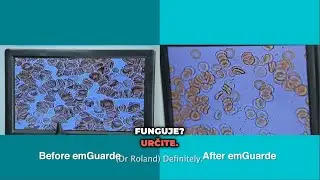 EMR Exposed  Dr  Roland odhaľuje zdravotn&eacute; rizik&aacute; a ochranu s emGuarde