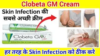 Clobeta gm Cream ll Skin Infection की सबसे अच्छी क्रीम ll Pharma lectures ll