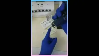 تحليل  D- Dimar  للدم