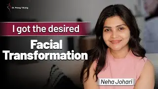 Transformative Chin Implant Experience | Patient Shares Journey with Leading Plastic Surgeon
