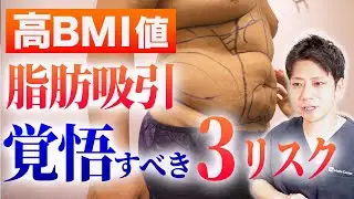 【対策可】高BMI値の方が高確率で起こる術後トラブル3選【皮膚たるみ、凸凹、痩せてない】｜脂肪吸引のモッズクリニック松元宗一郎