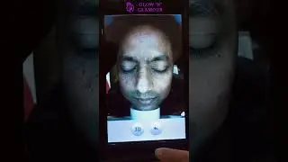 How does Artificial Intelligence based Face Skin Analyzer work? ( Bangla )