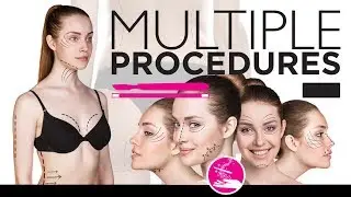 Multiple Procedures - Magic Surgeon Video Series