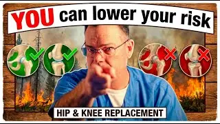 Hip & Knee Replacement: Lower Your Risks You Have More Control Than You Think