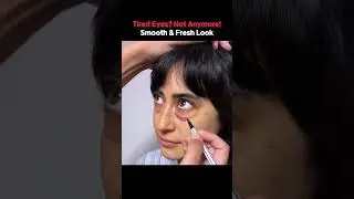 No More Eye Bags! 🔥 See the Stunning Before & After