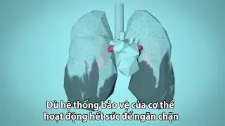 How does air pollution affect human health? &Ocirc; nhiễm kh&ocirc;ng kh&iacute; t&aacute;c động đến sức khoẻ như thế n&agrave;o?