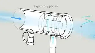 Dolby Vivisol - Expiratory Flow Accelerator - How Does It Work?
