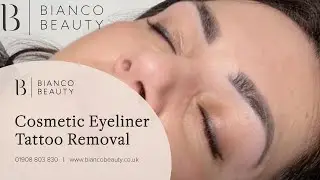How to remove eyeliner? Semi Permanent Makeup Removal, Laser Tattoo Removal Milton Keynes
