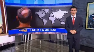 Hair Tourism | Jacob Daniel Eufemia