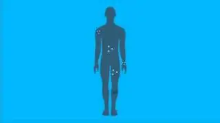 Quell Wearable Pain Relief Technology on QVC