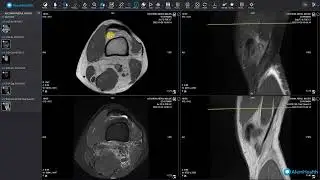 Introduction to the AlemHealth DICOM Viewer