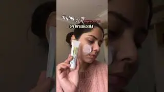 Trying 70₹ pimple / acne cream to see if it works 🙋🏻&zwj;♀️✨#skincare #shorts
