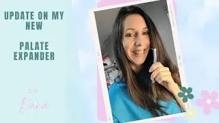 Week 1 with my palate expander