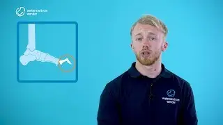 Hamertenen of Klauwtenen, wat kunt u eraan doen?