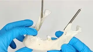 Mandibula