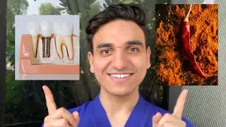 AVOID These Foods After Dental Implant Surgery For A *smooth* Recovery
