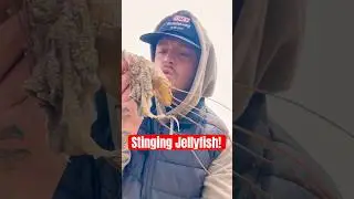 This is Why You NEVER Kiss Jellyfish! #animals #nature #shorts