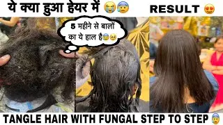 TANGLE HAIR के साथ FUNGAL भी बहुत है 😰|| STEP TO STEP BY GAURAV SIR ||