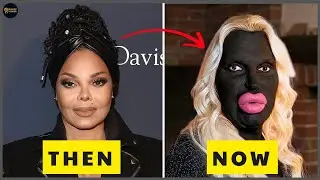 10 SHOCKING Plastic Surgery Disasters of Black Celebrities You Won’t Believe! | Then and Now 2026