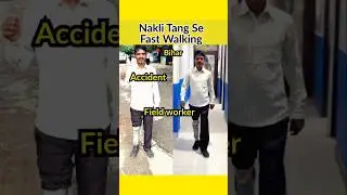 Fast Walking With Prosthetic Leg #artificialleg #bornlife #prosthesis #foryou #prostheticleg #shorts