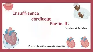 Insuffisance Cardiaque Partie 3: Insuffisance Systolique Et Diastolique.